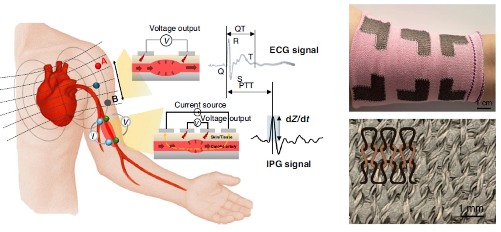 A textile-based alignment-free electrophysiological sensing sleeve for comprehensive cardiovascular monitoring