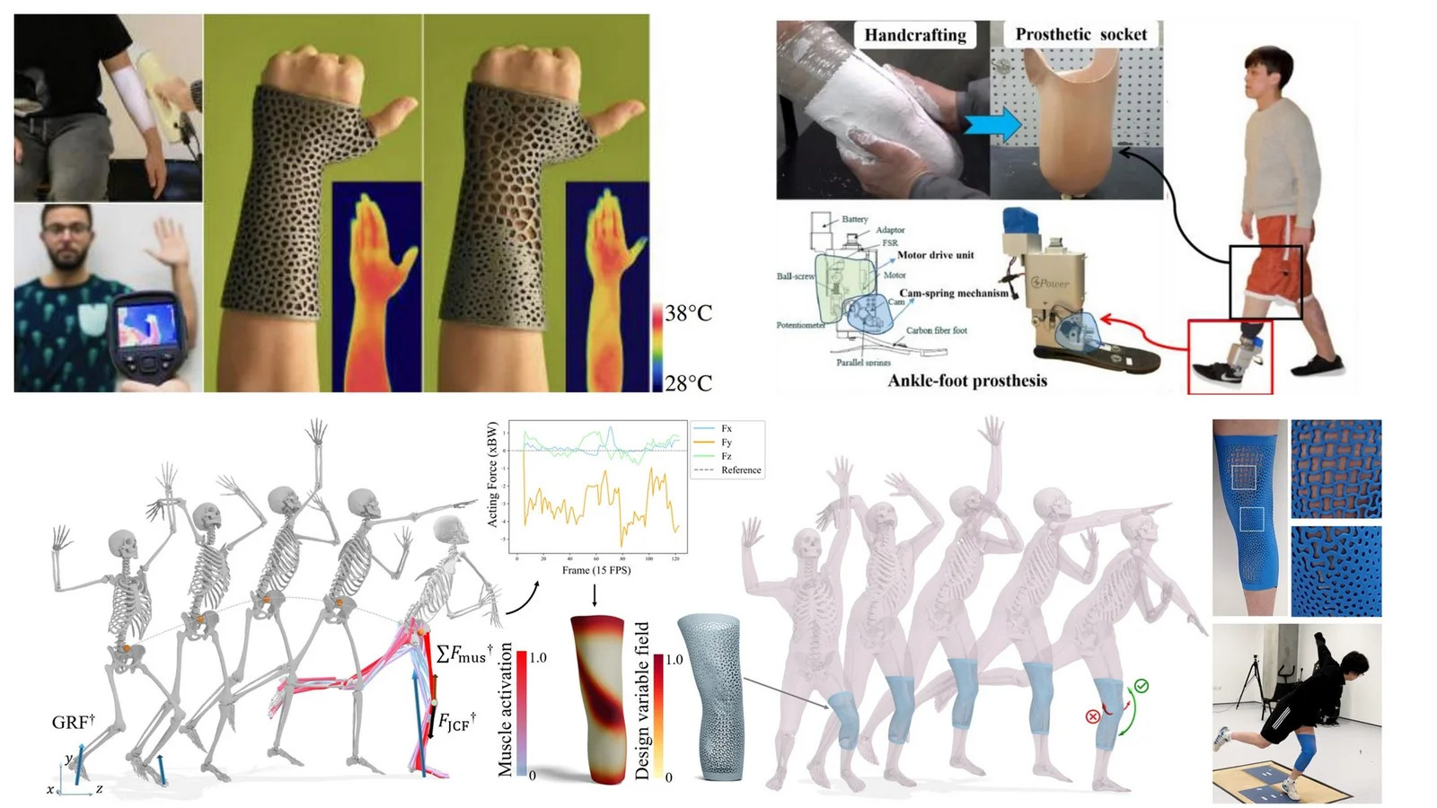 Personalized wearable devices and computational biomechanics