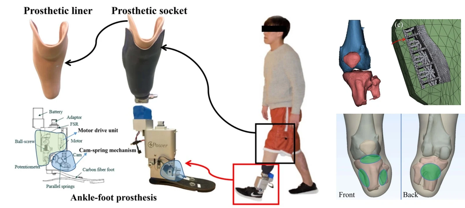 Design and 3D printing of lower limb prosthetic socket with metamaterials for performance enhancement